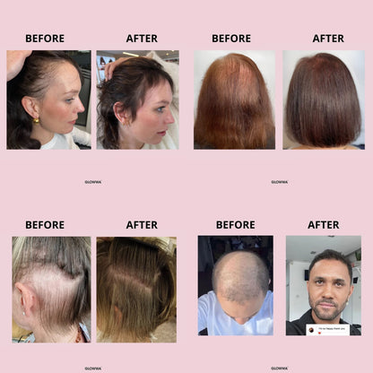 Glowwa Hair Food - Original 60 caps